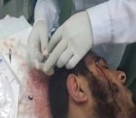 مبتز يصيب رأس عضو الهيئة بساطور بسكاكا